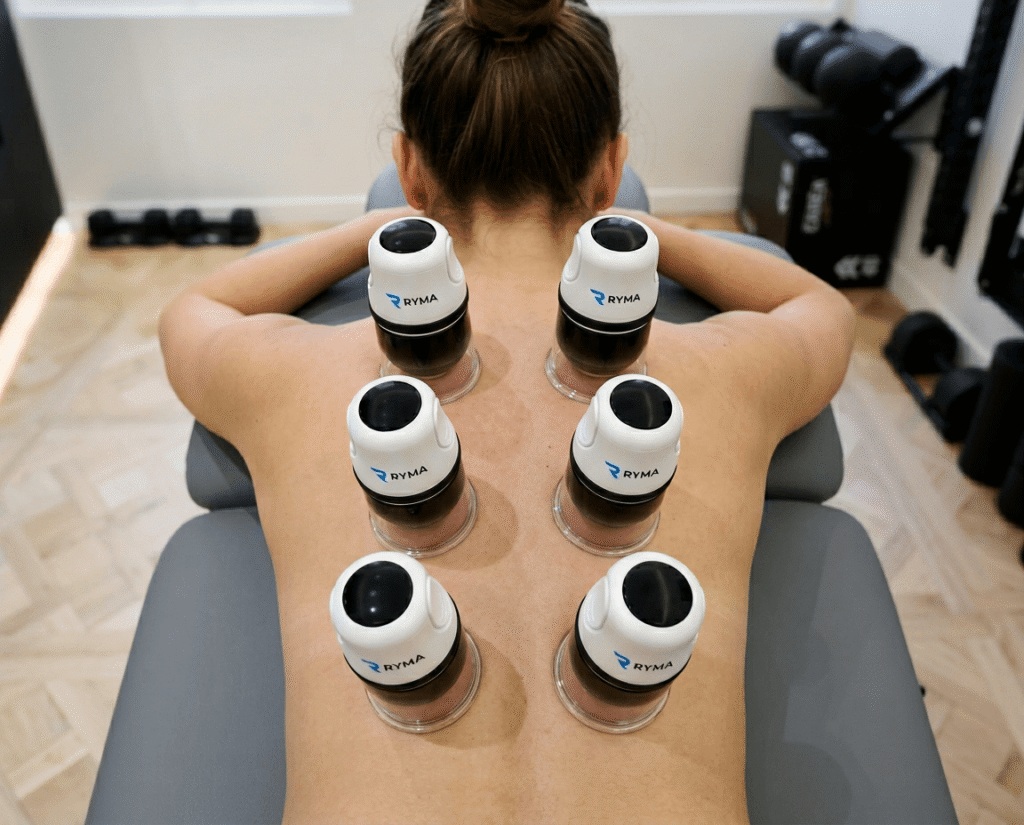 Cupping therapy Paris